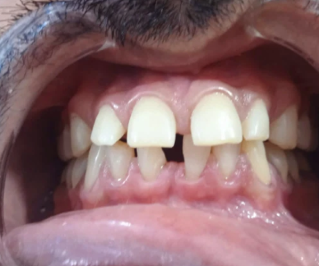 Aesthetic treatment before treatment