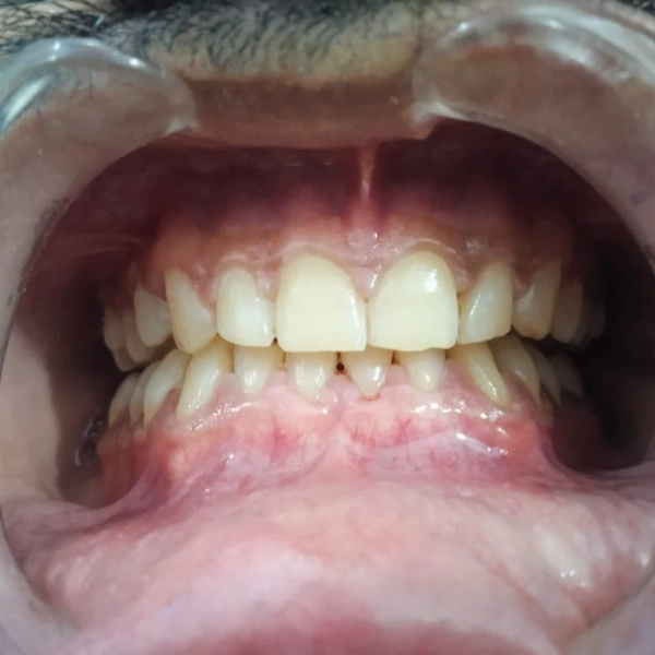 Aesthetic treatment after treatment
