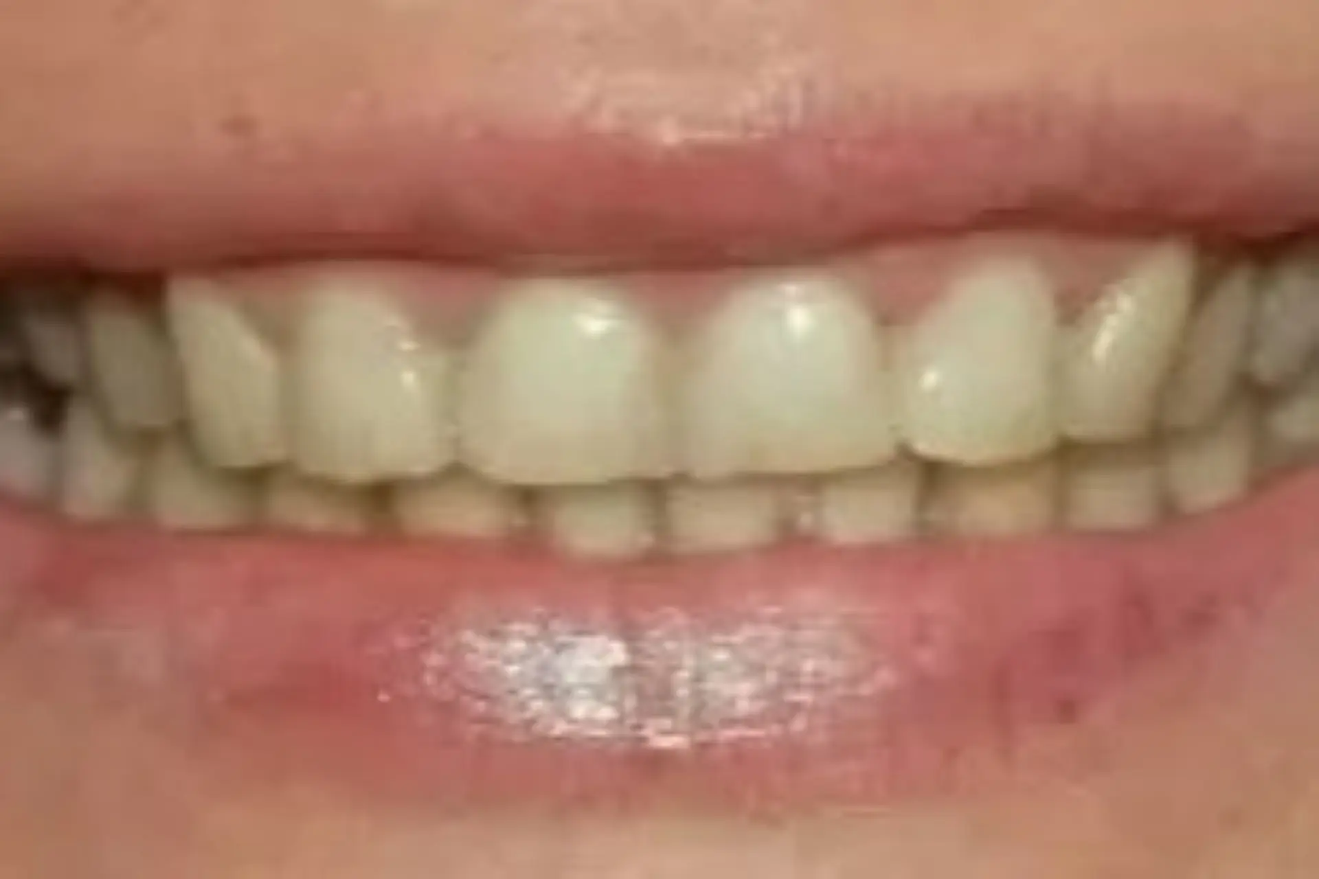 Dental rehabilitation before treatment